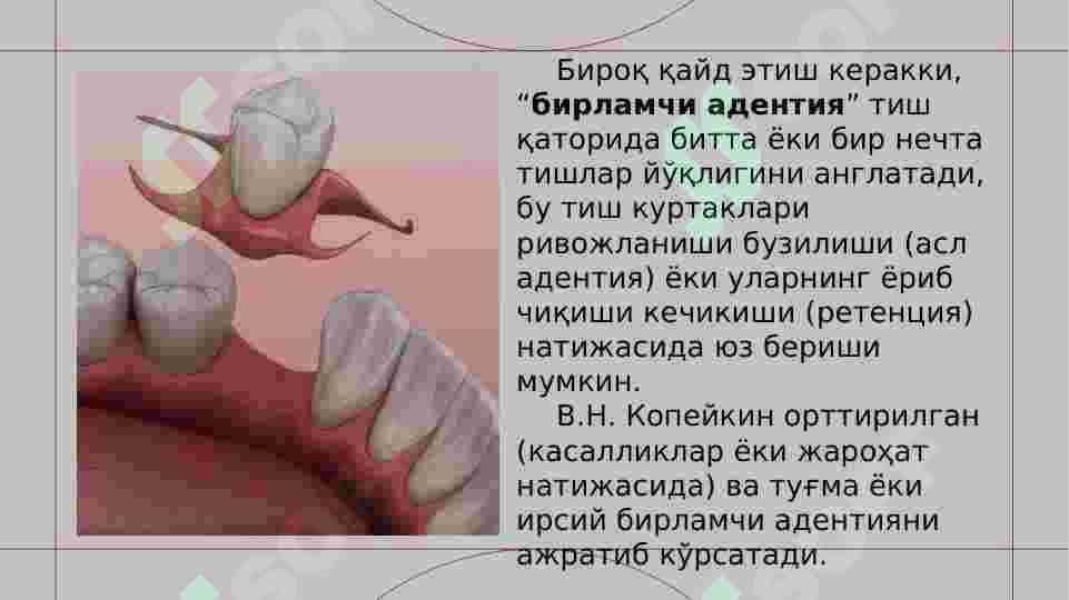 ТИШ ҚАТОРЛАРИНИНГ ҚИСМАН НУҚСОНИНИ ТАСНИФЛАРИ ВА УНИНГ КЛИНИК ҲОЛАТИ.  ТИШ ҚАТОРИНИ МУСТАҚИЛ ИШЛАЙДИГАН ТИШЛАР ГУРУҲИГА БЎЛИНИЛИШИ.  ФУНКЦИОНАЛ ВА НОФУНКЦИОНАЛ ТИШЛАР ГУРУҲЛАРИ ПАЙДО БЎЛИШИ. ПАРОДОНТНИНГ ФУНКЦИОНАЛ ЮКЛАНИЛИШИ.  ТИШ ҚАТОРЛАРИНИНГ ДЕФОРМАЦИЯСИ. ЭСТЕТИК НОРМАЛАРНИ, ГАПИРИШ ВА ЧАЙНОВ ФУНКЦИЯЛАРНИ БУЗИЛИШИ. ТИШЛАРНИНГ ЙУҚОТИЛИШИ БИЛАН БОҒЛИҚ ЧАККА-ПАСТКИ ЖАҒ БЎҒИМИНИНГ ЎЗГАРИЛИШИ. 4