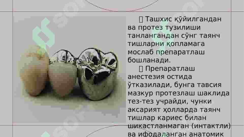 КАВШАРЛАНГАН КЎПРИКСИМОН ПРОТЕЗЛАРНИ ТАЙЁРЛАНИШИНИНГ КЛИНИК- ЛАБОРАТОР БОСҚИЧЛАРИ. КЎПРИКСИМОН ПРОТЕЗЛАРНИНГ ТАНАСИНИНГ  ТУРЛАРИ ВА УЛАРНИНГ ҚЎЛЛАНИЛИШИНИНГ УЗИГА ҲОС ТОМОНЛАРИ 2
