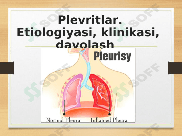 Plevritlar. Etiologiyasi, klinikasi, davolash usullari 1