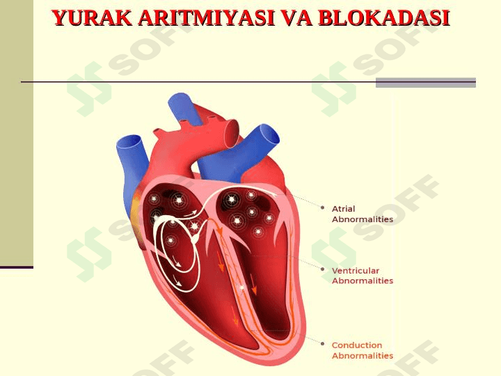 YURАK АRITMIYASI VA BLOKADASI 1