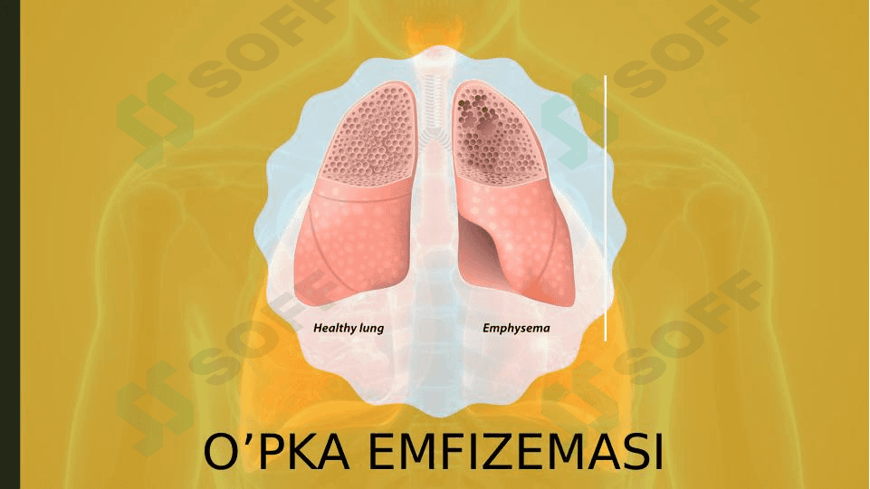 O'PKA EMFIZEMASI 1