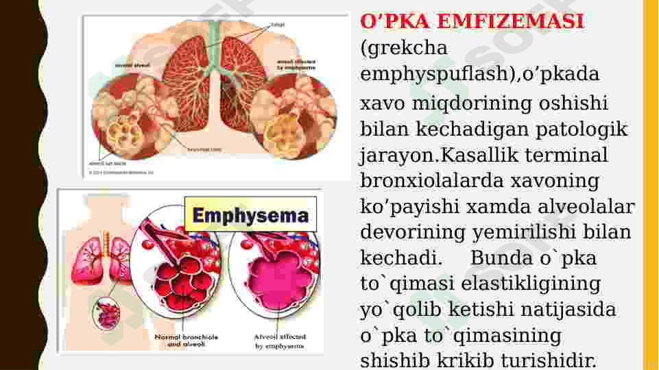 O'PKA EMFIZEMASI 2