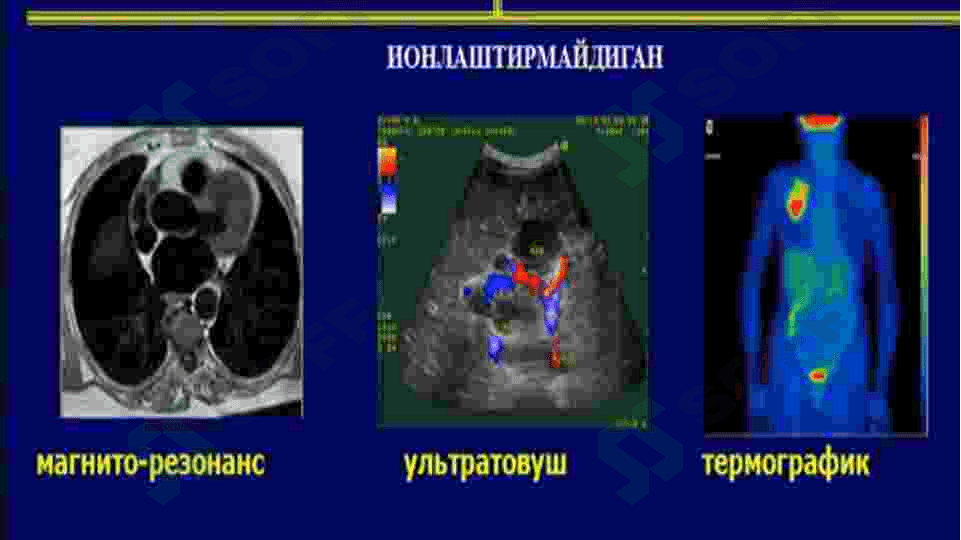 MRT RADIOLOGIYA 2