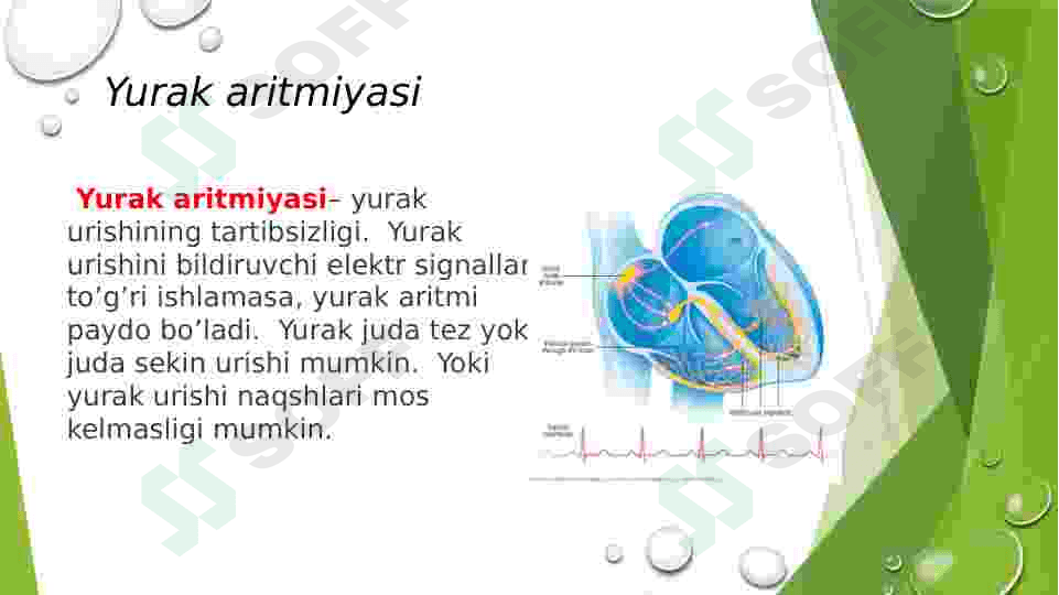 yurak aritmiyalari EKG diagnostikasi 2