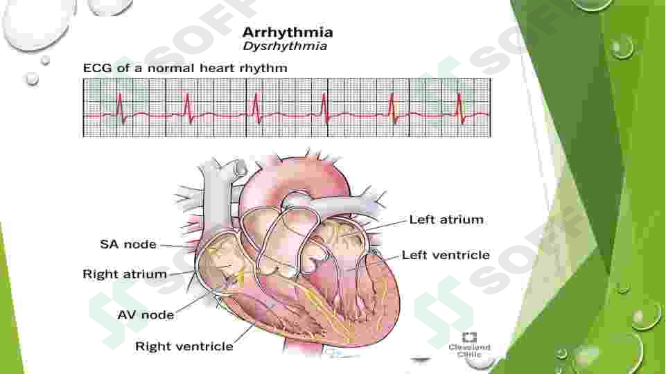 yurak aritmiyalari EKG diagnostikasi 3
