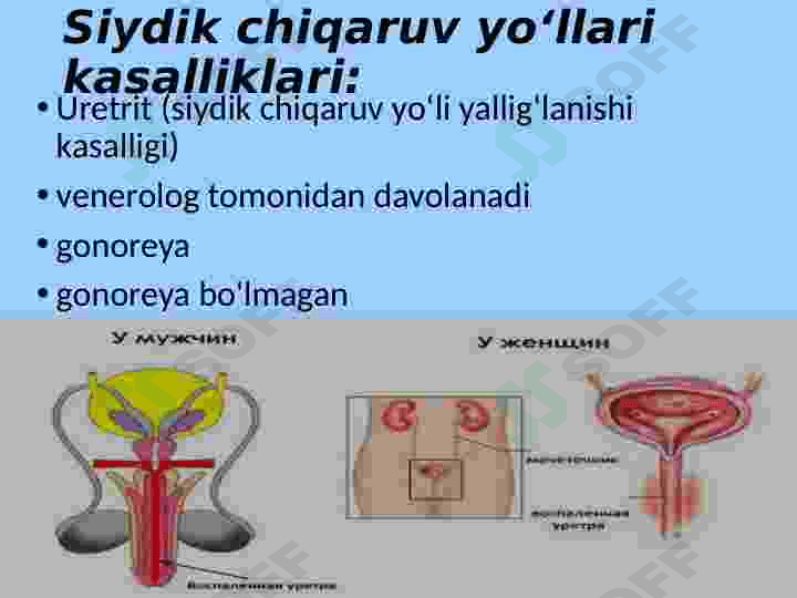 Siydik chiqarish yoʻllari kasalliklari 3