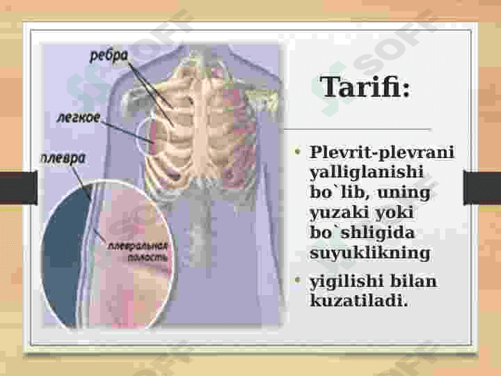 Plevritlar. Etiologiyasi, klinikasi, davolash usullari 3
