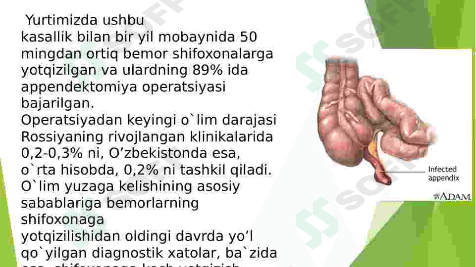 Oʻtkir apendisitni klinikasi 3