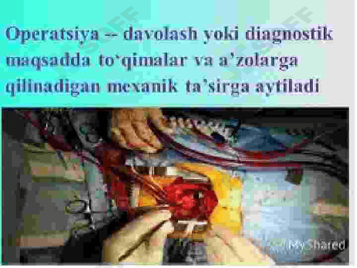 Operatsiyadan oldingi davr. Bemorlarni operatsiyaga tayyorlash. 3
