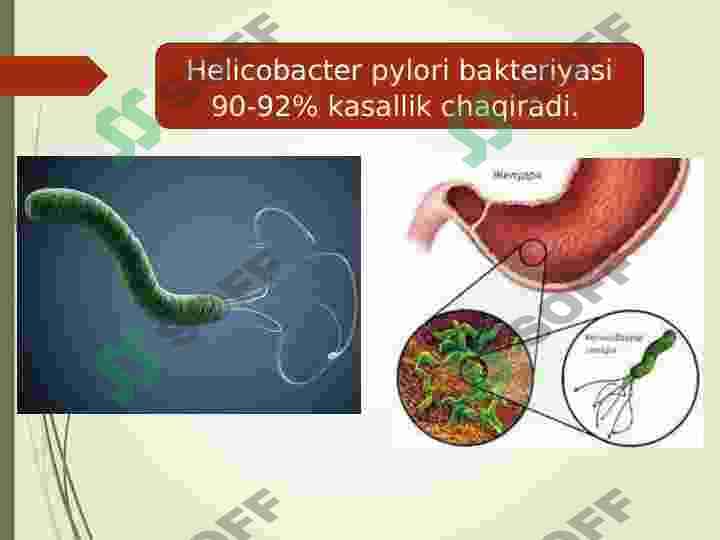 Gastritlar. Me'da va 12 barmoq ichak yara kasalligi ,sabablari, klinikasi va davolash profilaktikasi 3