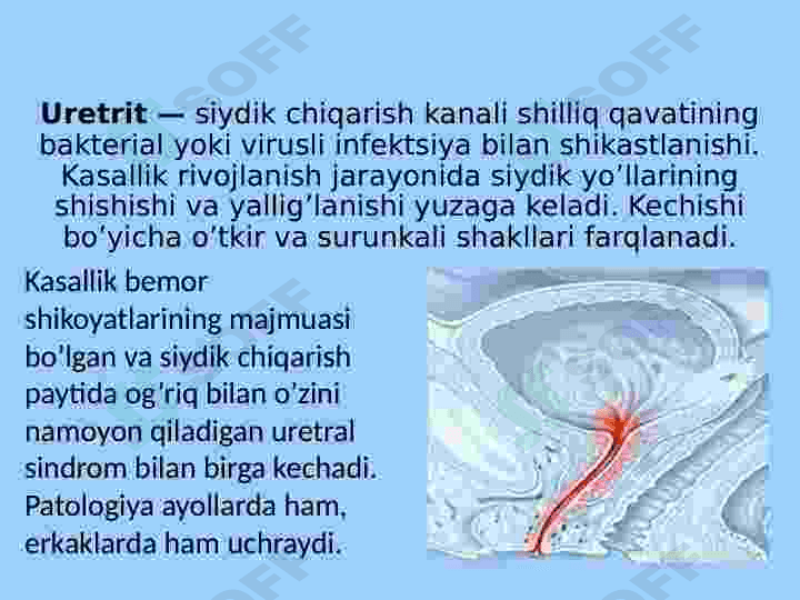 Siydik chiqarish yoʻllari kasalliklari 4
