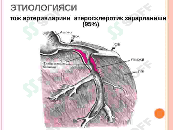 MIOKARD INFARKTI. STENOKARDIYALAR 5