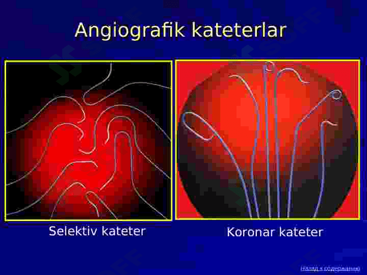 Angiografiya va intervension radiologiya. Qon tomirlari patologiyalarining angiografiyasi 5