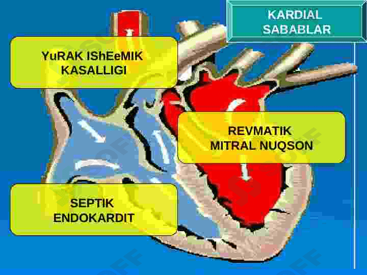 O‘TKIR ARTERIAL,TROMBOZ VA EMBOLIYALAR 6