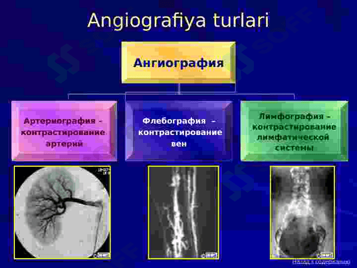 Angiografiya va intervension radiologiya. Qon tomirlari patologiyalarining angiografiyasi 6