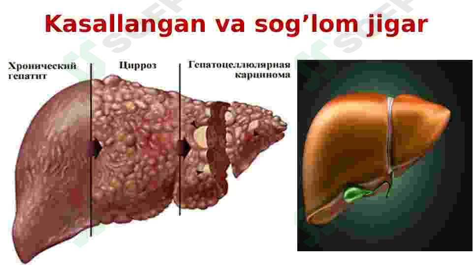 Qon infeksiyalari 6