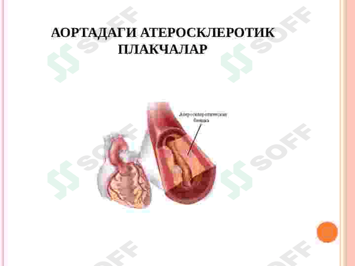 MIOKARD INFARKTI. STENOKARDIYALAR 6