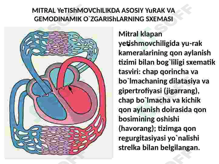 Yurak mitral va aortal nuqsonlari 7