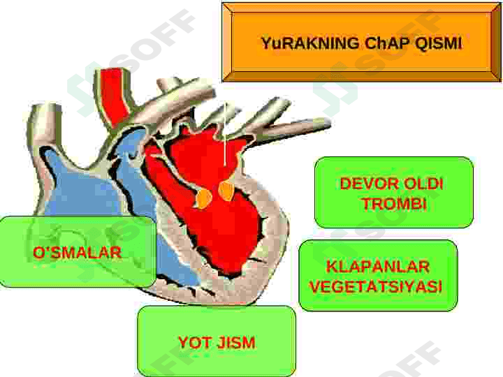 O‘TKIR ARTERIAL,TROMBOZ VA EMBOLIYALAR 7