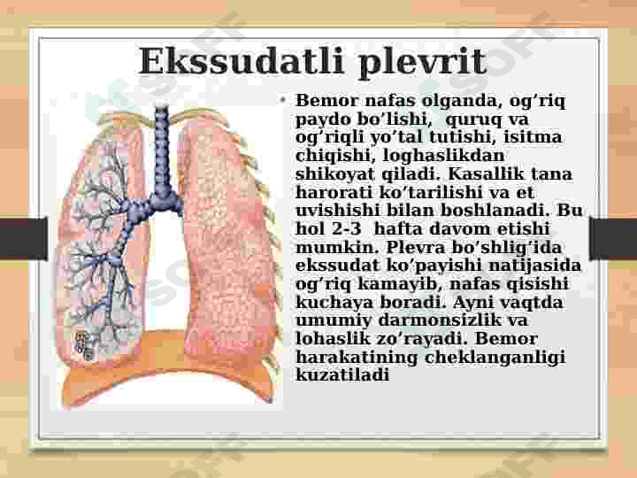Plevritlar. Etiologiyasi, klinikasi, davolash usullari 7
