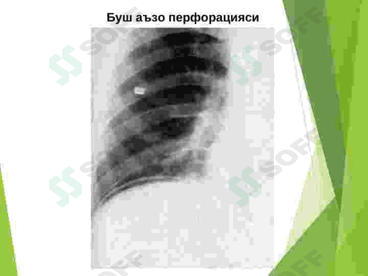 Ошкозон-ичак касалликларининг нур ташхиси 7