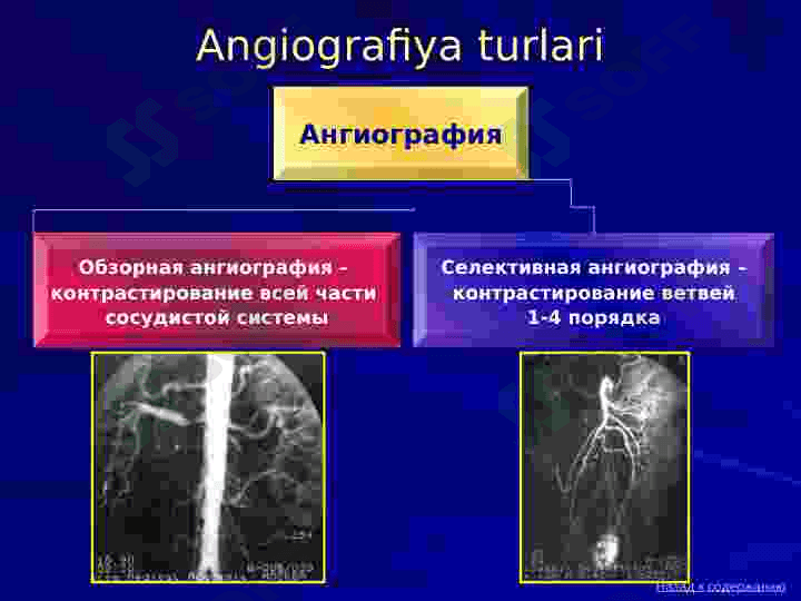 Angiografiya va intervension radiologiya. Qon tomirlari patologiyalarining angiografiyasi 7
