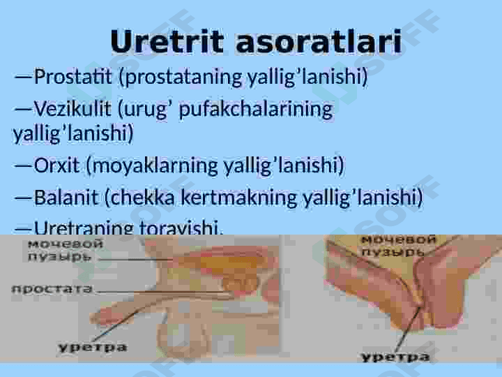 Siydik chiqarish yoʻllari kasalliklari 7