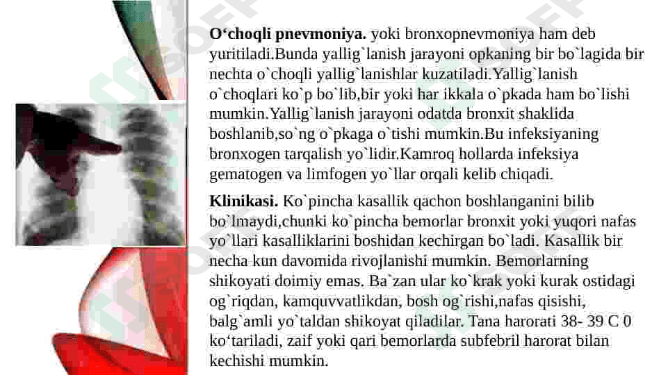 Nafas a‘zolari kasalliklaridagi funksional - instrumental tekshiruvlarrentgenogrammalar interpretatsiyasi 8