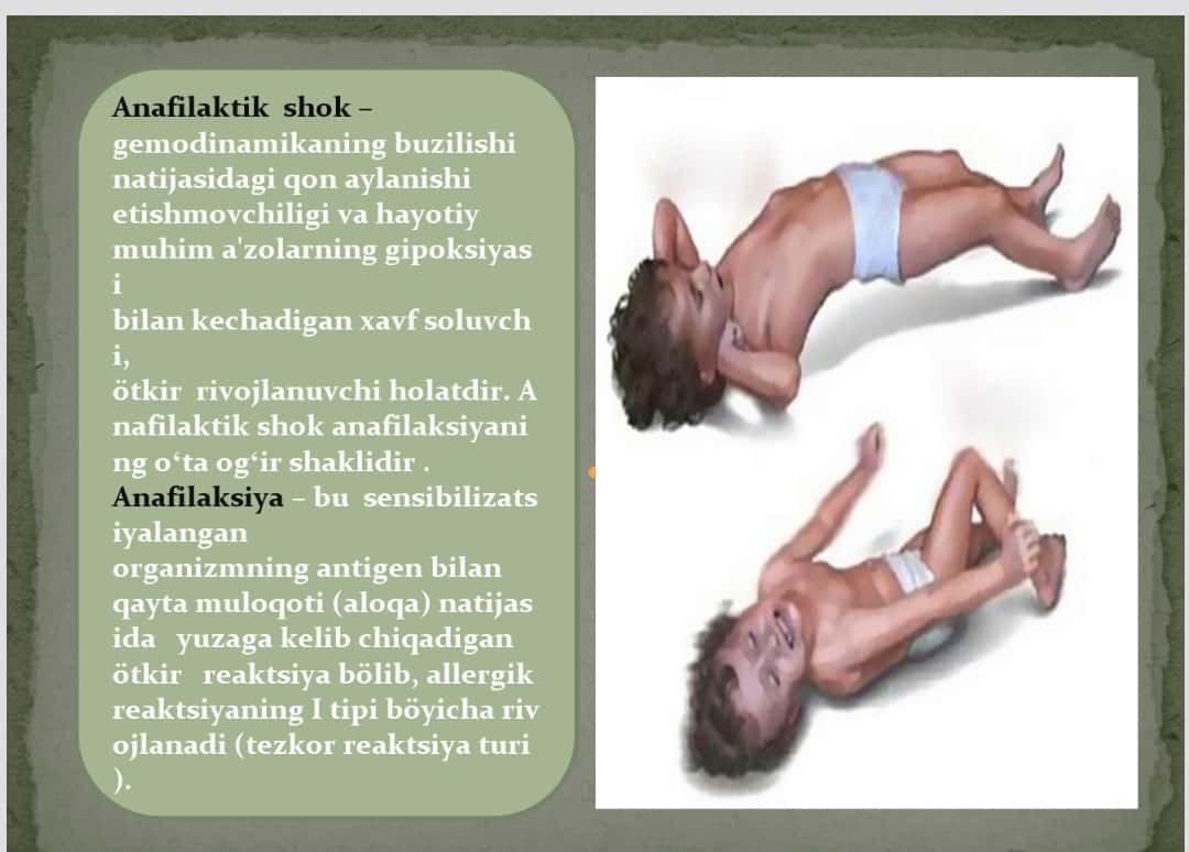 Anafilaktik  shok 1