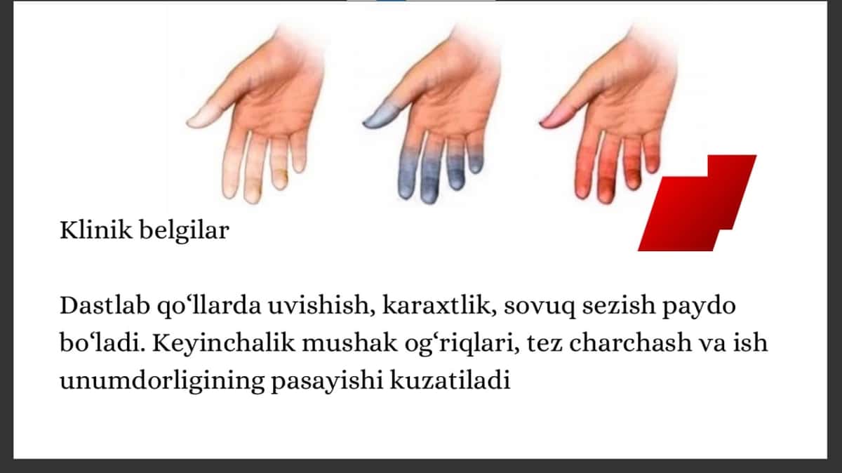 Korxonalarda tebranish vaziyatlarini tekshirish va baholash 2