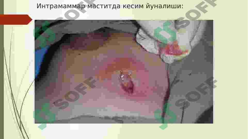 Jinsiy siklining gormonal boshqarilishi 5