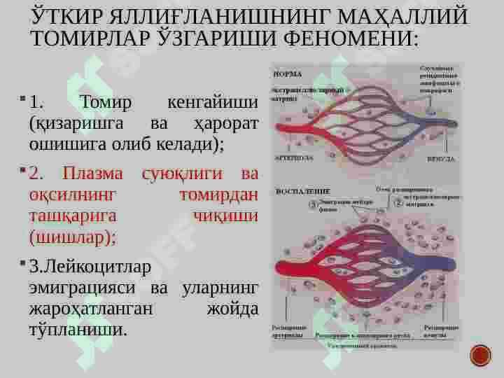 Яллиғланиш ва репаратця. Ўткир ва сурункали яллиғланиш. Яллиғланиш медиаторлари. Яллиғланишнинг морфологик белгилари ва оқибатлари 8