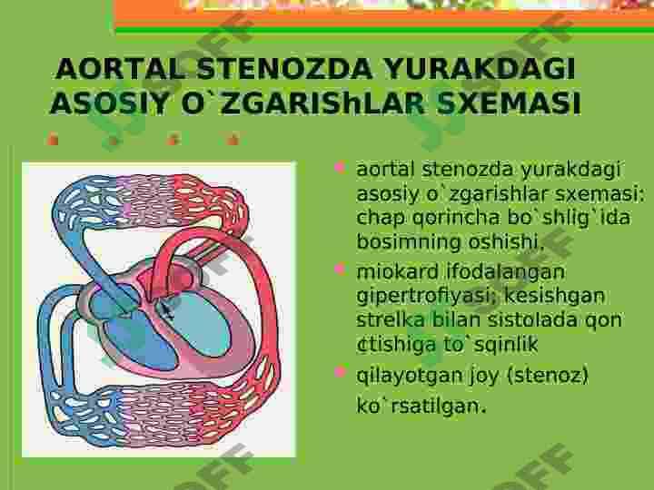 Aorta yetishmovchiligi 4