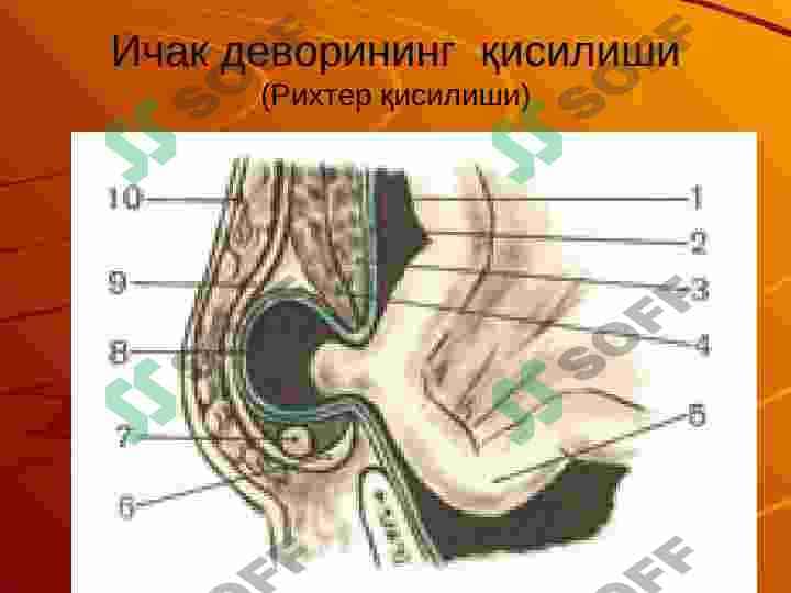 Churralar asoratlari 5