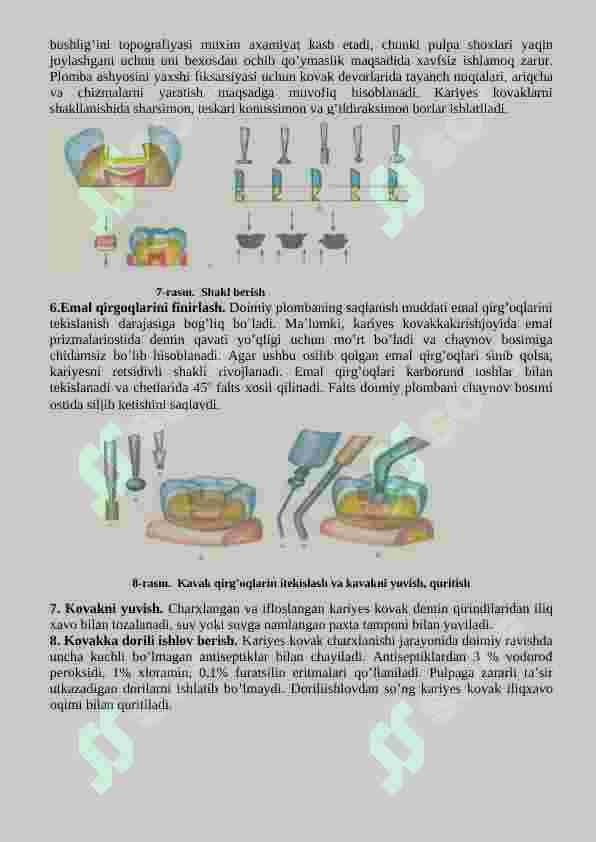 Tish qattiq to‟qimalarini charxlash bosqichlari va tamoyillari. Fantomlarda I sinf karioz bo‟shliqlarini charxlash va plombalash 4