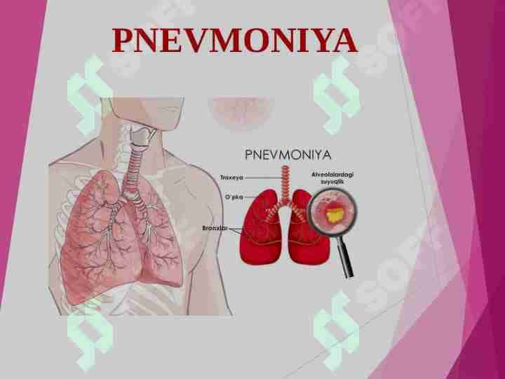 PNEVMONIYA