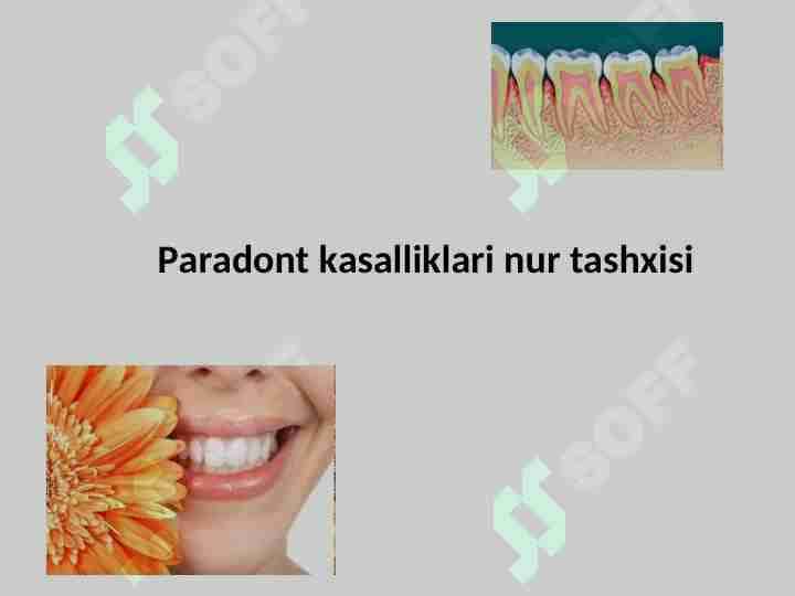 Paradont kasalliklari nur tashxisi