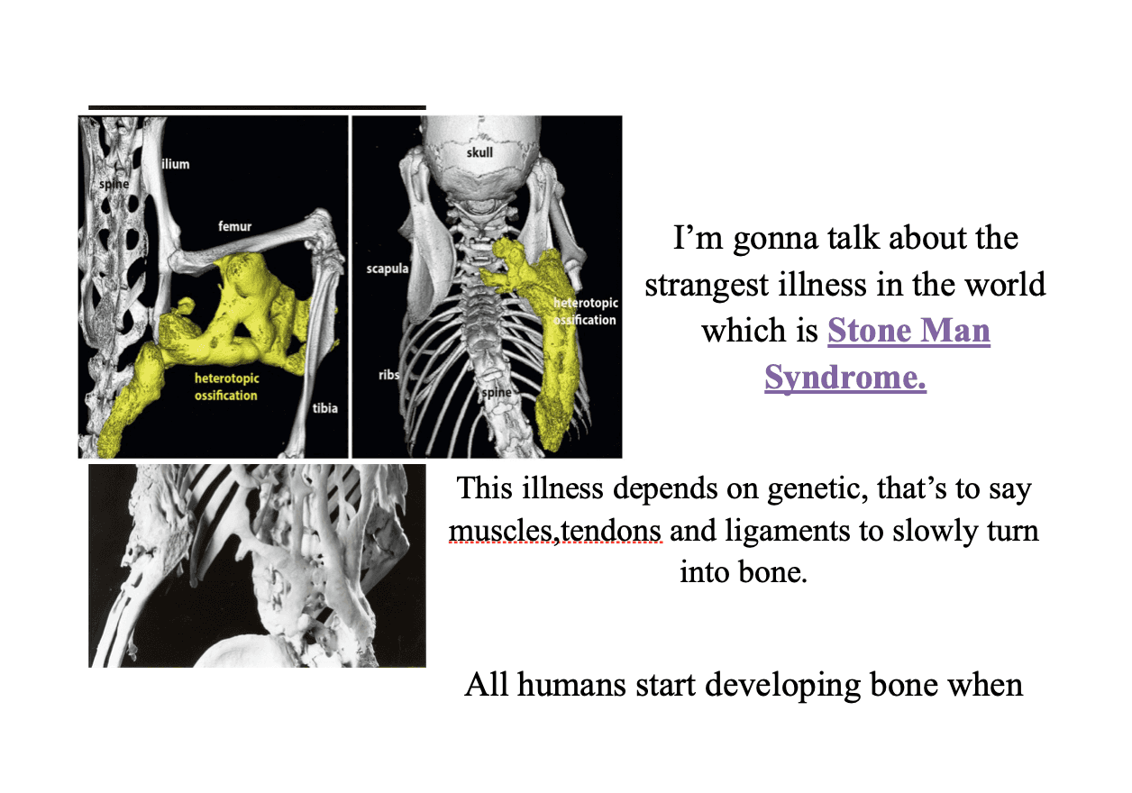 Stone Man Syndrome 2