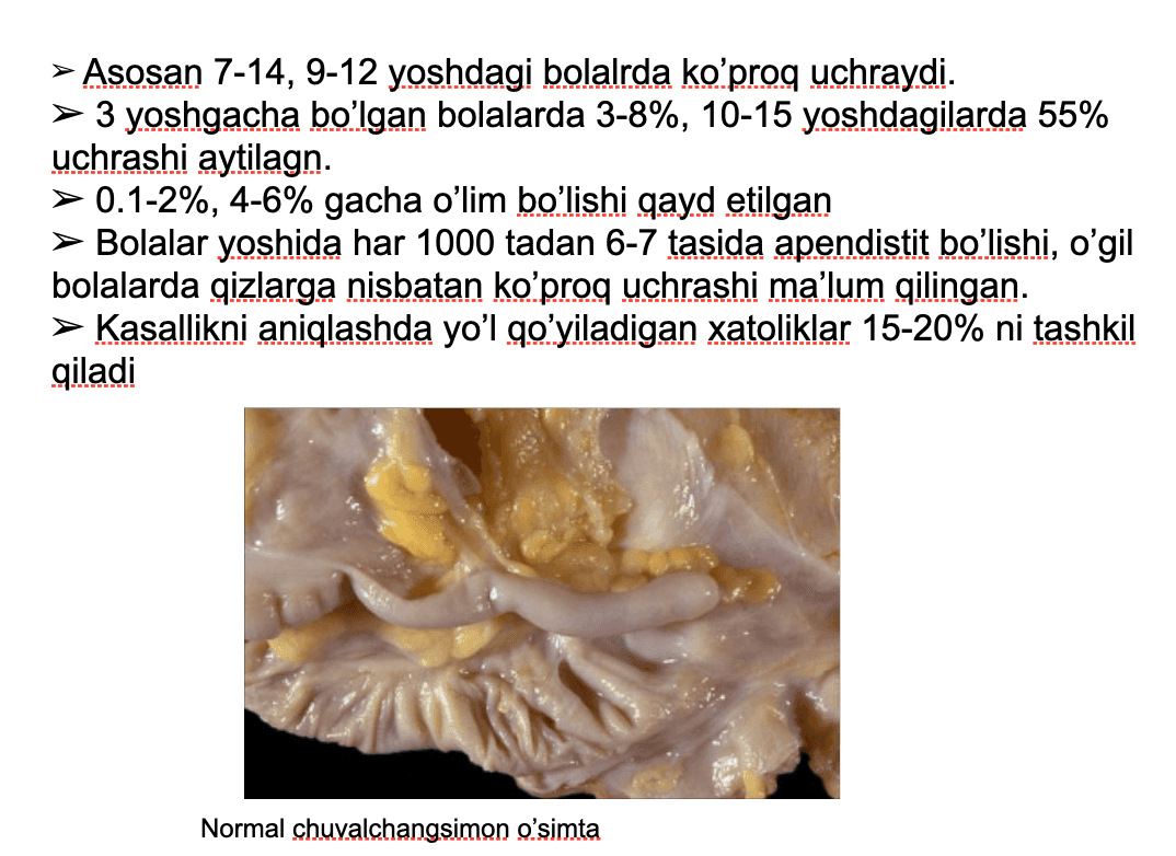 3 yoshgacha bo’lgan bolalarda O`tkir appenditsit 4