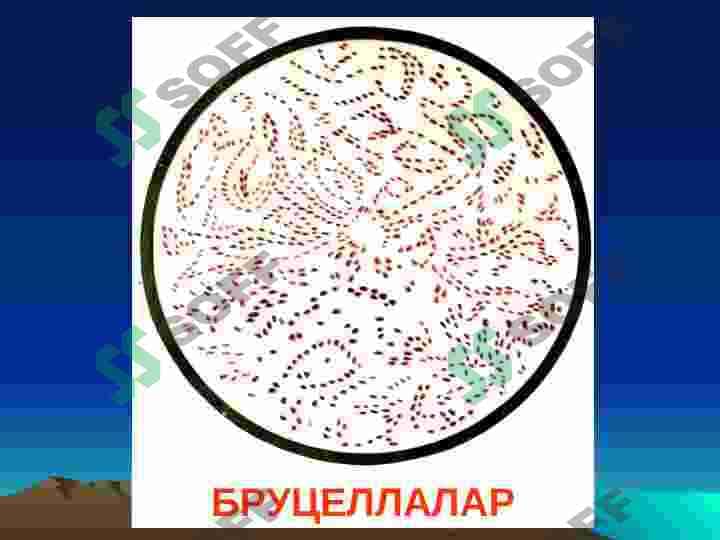 БРУЦЕЛЛЕЗ 8