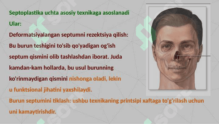 Septoplastika operatsiyasi 7