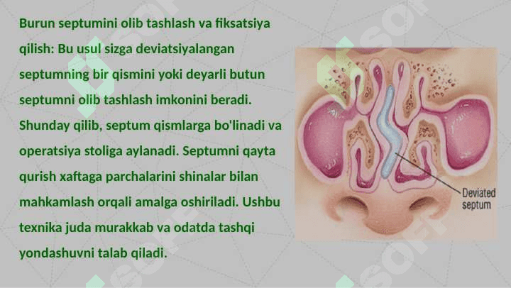 Septoplastika operatsiyasi 8