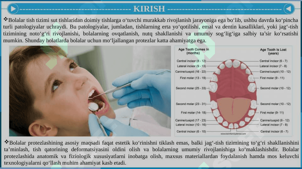 Bolalar protezlarining o‘ziga xos xususiyatlari 3