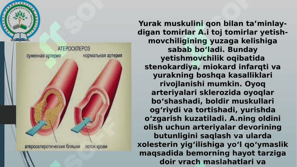 Toj tomirlar aterosklerozi 4