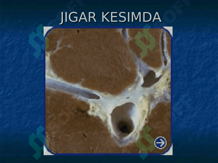 JIGAR SIRROZI 3