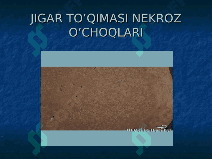 JIGAR SIRROZI 4
