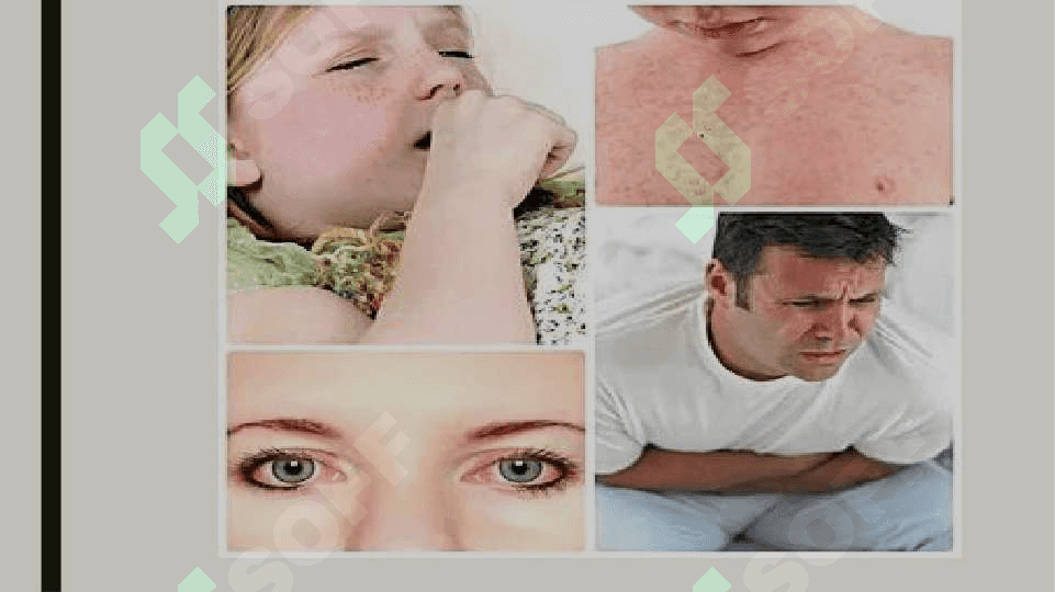 Allergik kasalliklarni klinik va labarator tashxislash usullar 7