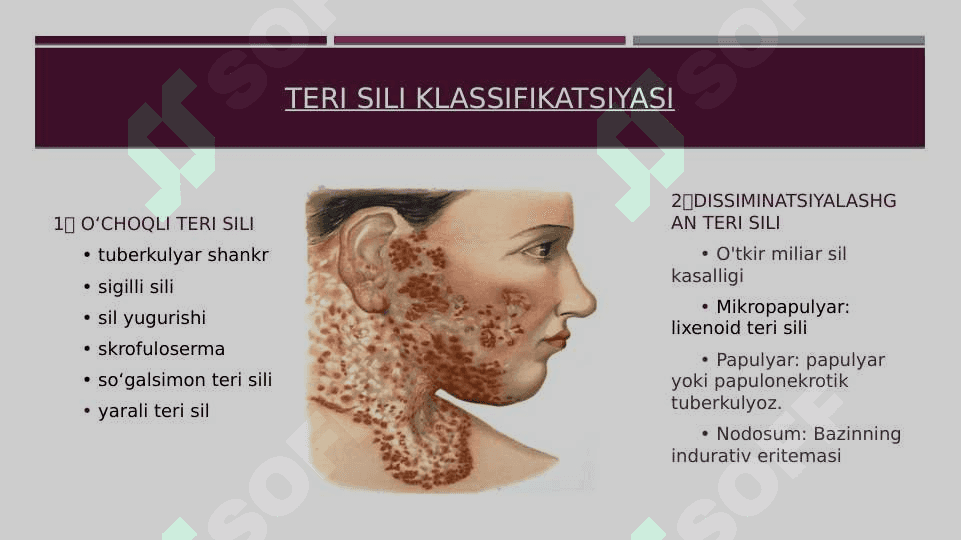 Teri sili 3