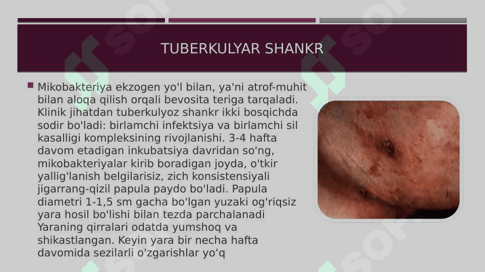 Teri sili 4