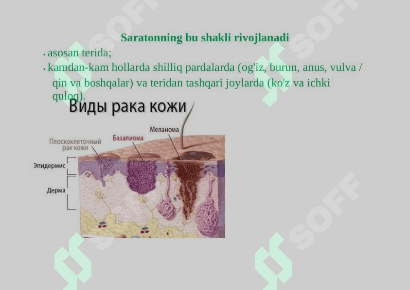 Teri raki, Teri melanomasi: turlari, belgilari, tashxisi va eng so'nggi davolash usullari 3